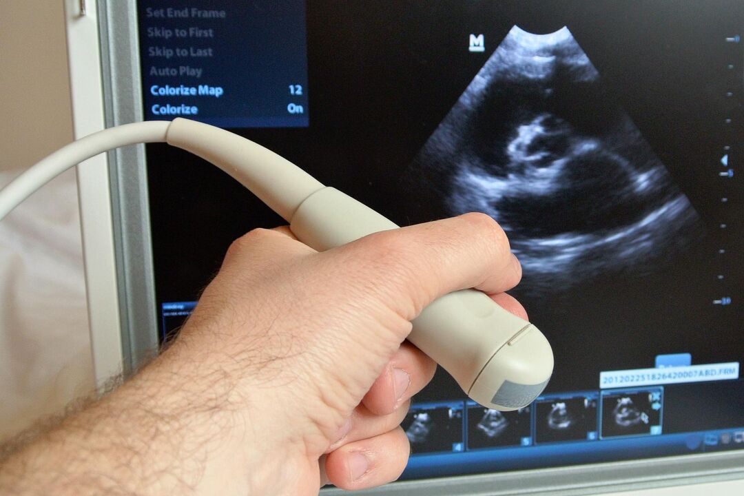 L'échographie aide à diagnostiquer la prostatite congestive chez un homme